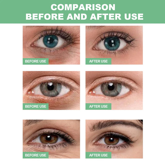 60 Pieces Aloe Vera Collagen Eye Mask for Dark Circles-1