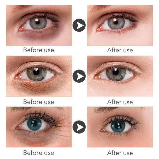 Retinol Anti-aging Whitening Serum-1